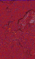     NOAA 18 