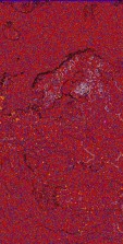     NOAA 18 