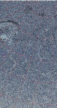     NOAA 18 
